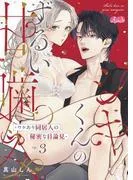 シキくんのずるい甘噛み ~ワケあり同居人の秘密な目論見~