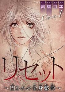 リセット～囚われの全身整形～1　Case.1 鏡よ鏡 前編